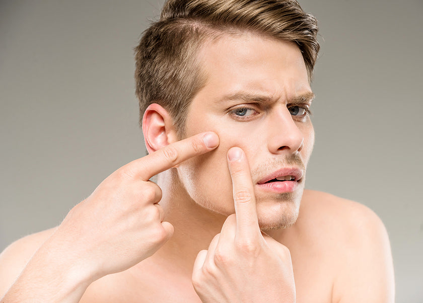 man with zit man with zit